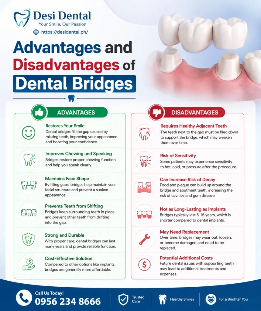 Advantages and Disadvantages of Dental Bridges