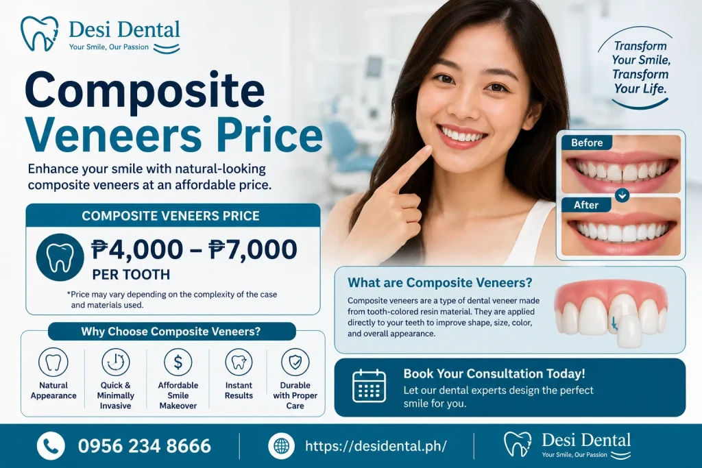 Composite Veneers Price