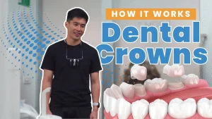 Dental Crown Prices in the Philippines
