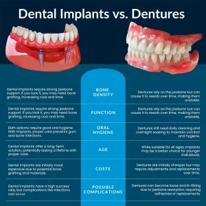 Dentures vs Implants