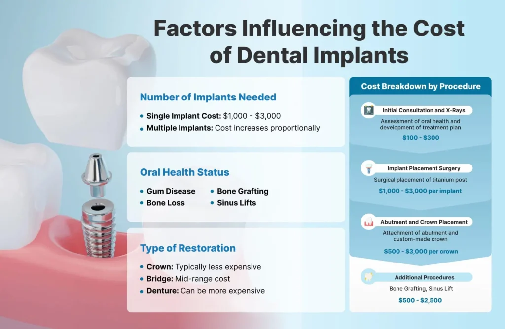 Factors That Can Affect the Cost of Dental Implants