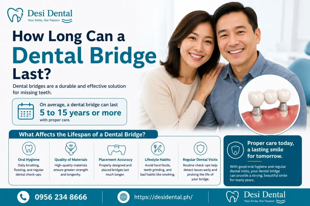 How Long Can a Dental Bridge Last