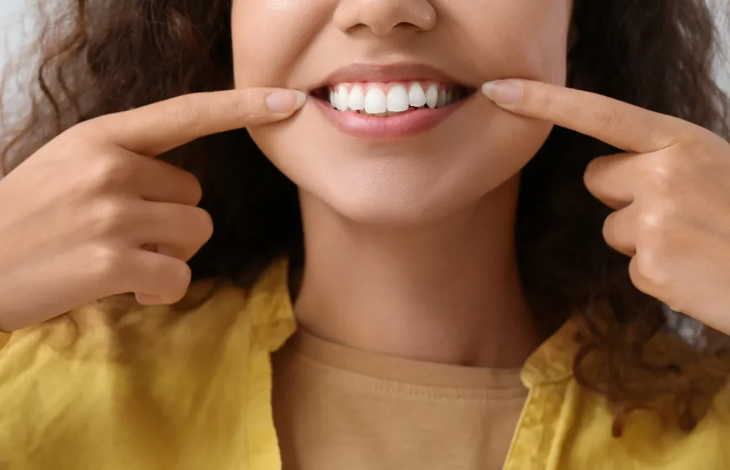 How much is Veneers in the Philippines