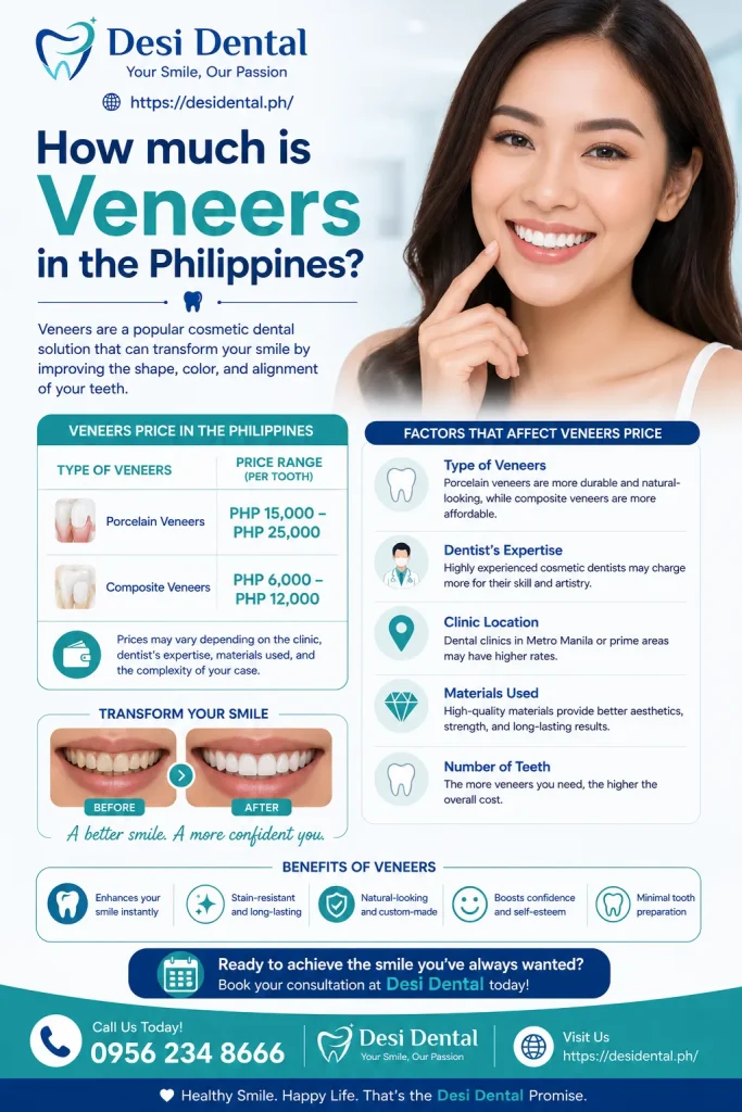 How much is Veneers in the Philippines