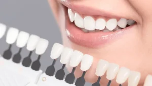 How much is teeth whitening in the Philippines