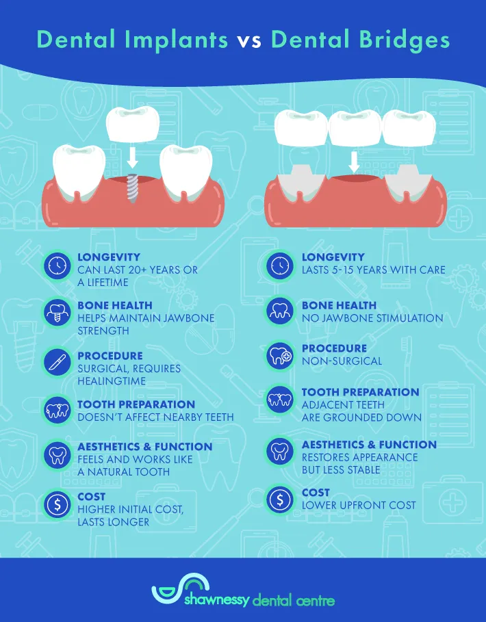 Key Differences Dental Bridge vs Implant