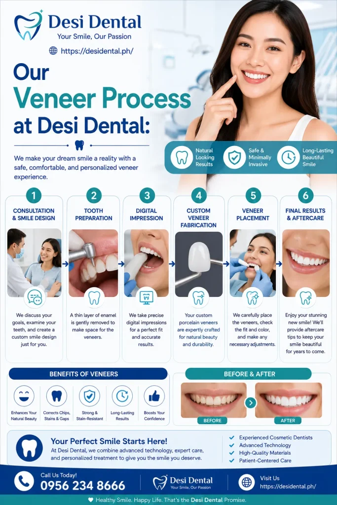 Our Veneer Process at Desi Dental
