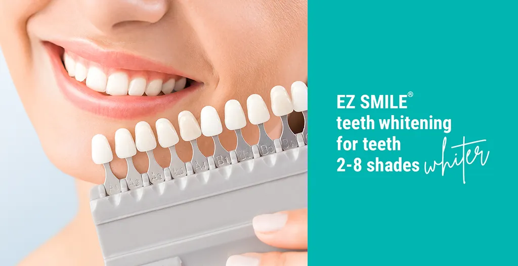 What Affects the Cost of Teeth Whitening