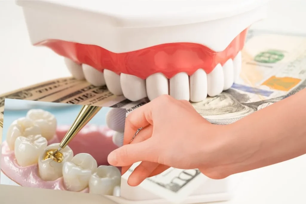 What Affects the Cost of Tooth Fillings