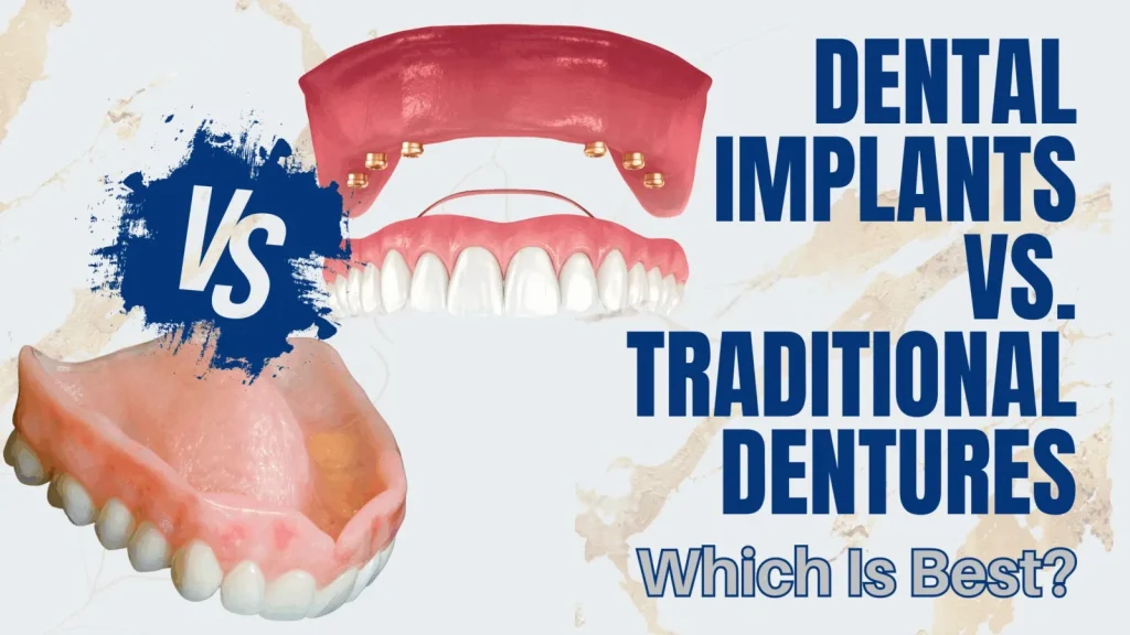 Why Choose Denture Implants Instead of Traditional Dentures