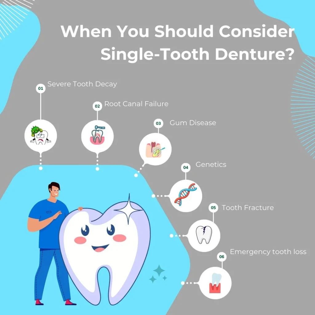 Advantages of a 1 Tooth Denture