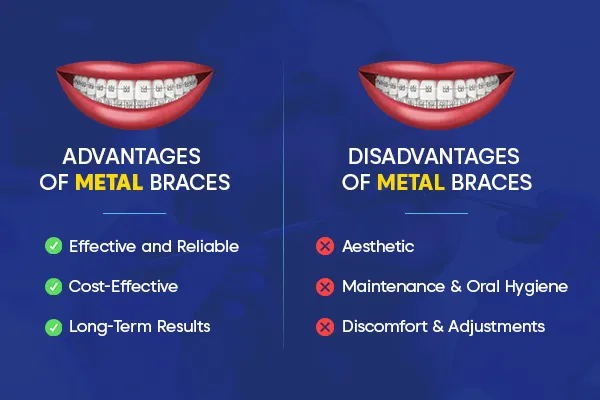 Benefits of Metal Braces