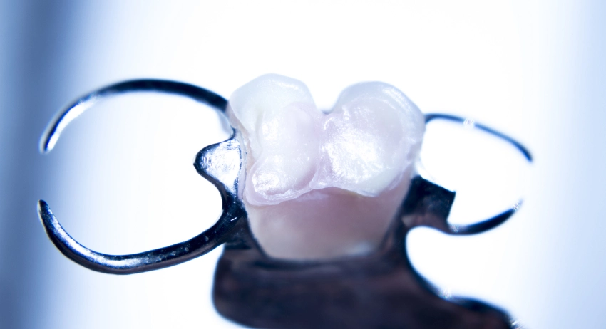 Types of 1 Tooth Denture