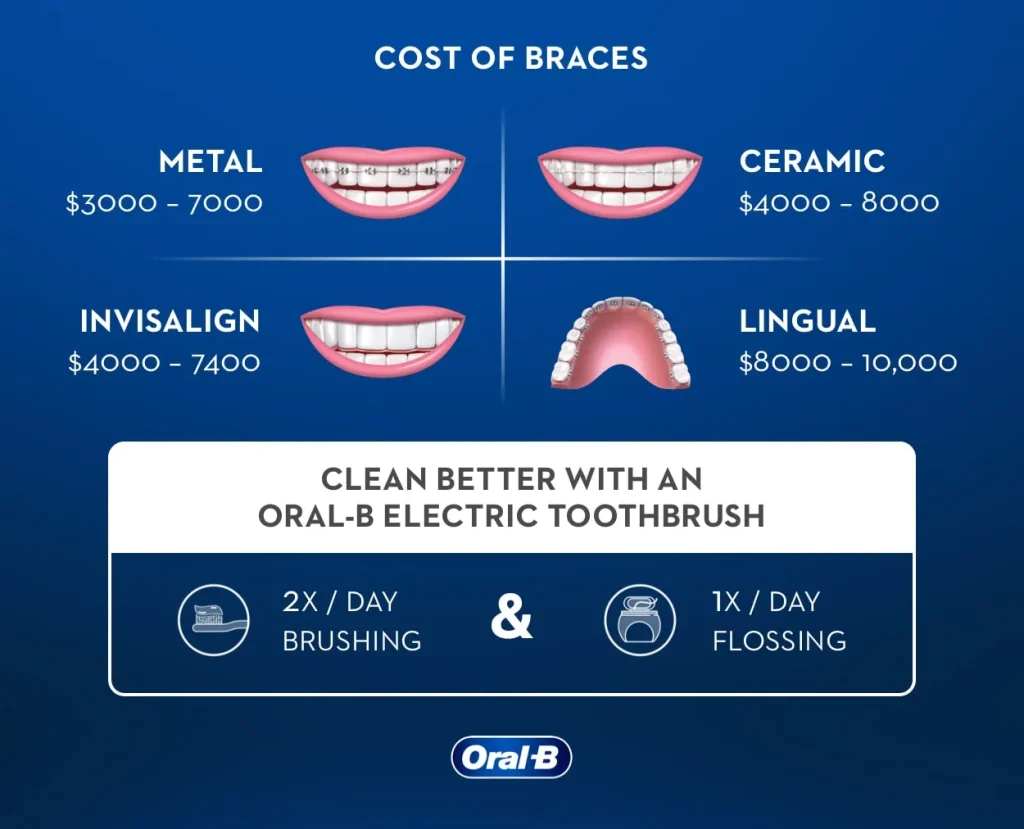 Why Do Lingual Braces Cost More