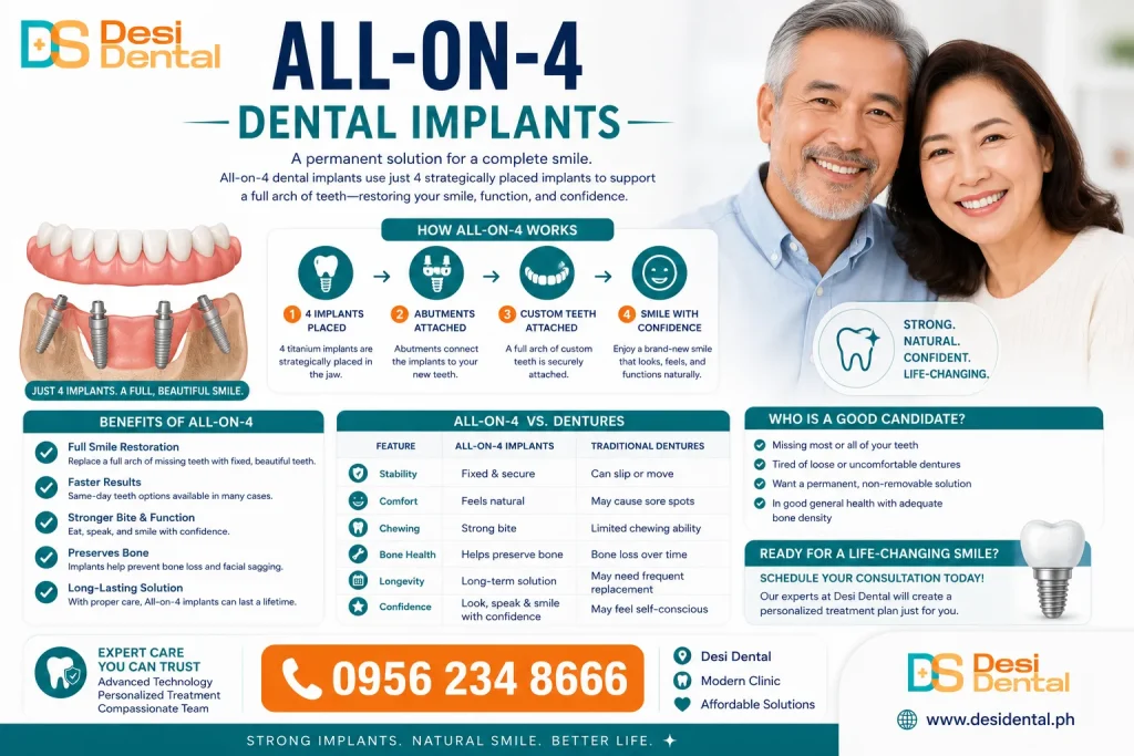All-on-4 Dental Implants