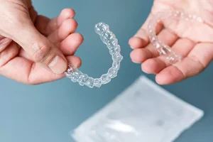Clear Aligners Price