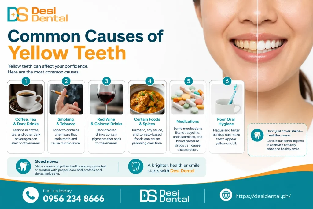 Common Causes of Yellow Teeth