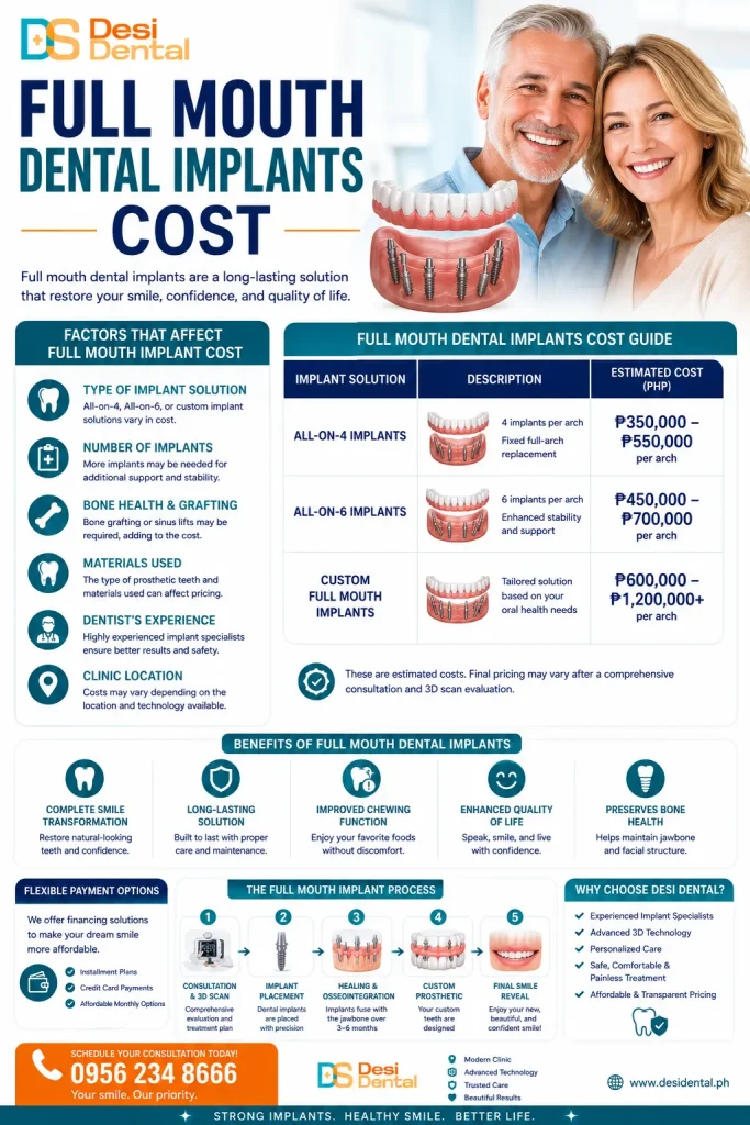 Full Mouth Dental Implants Cost