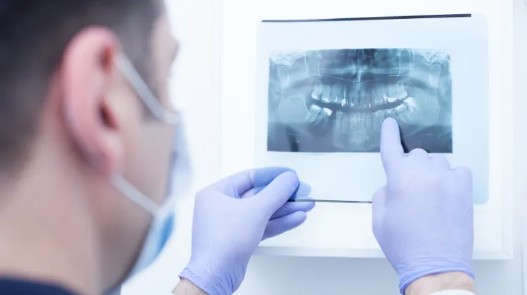 Panoramic X-Ray