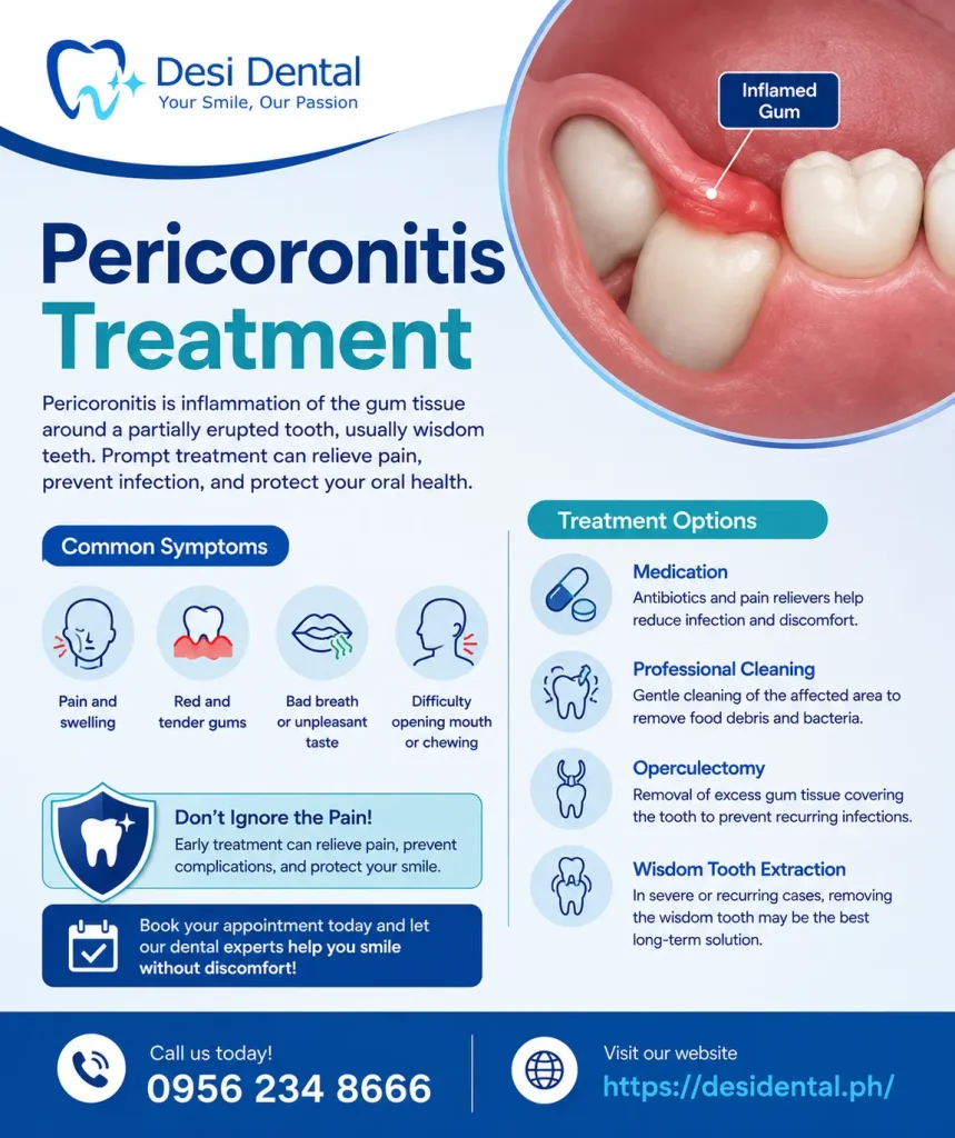 Pericoronitis Treatment