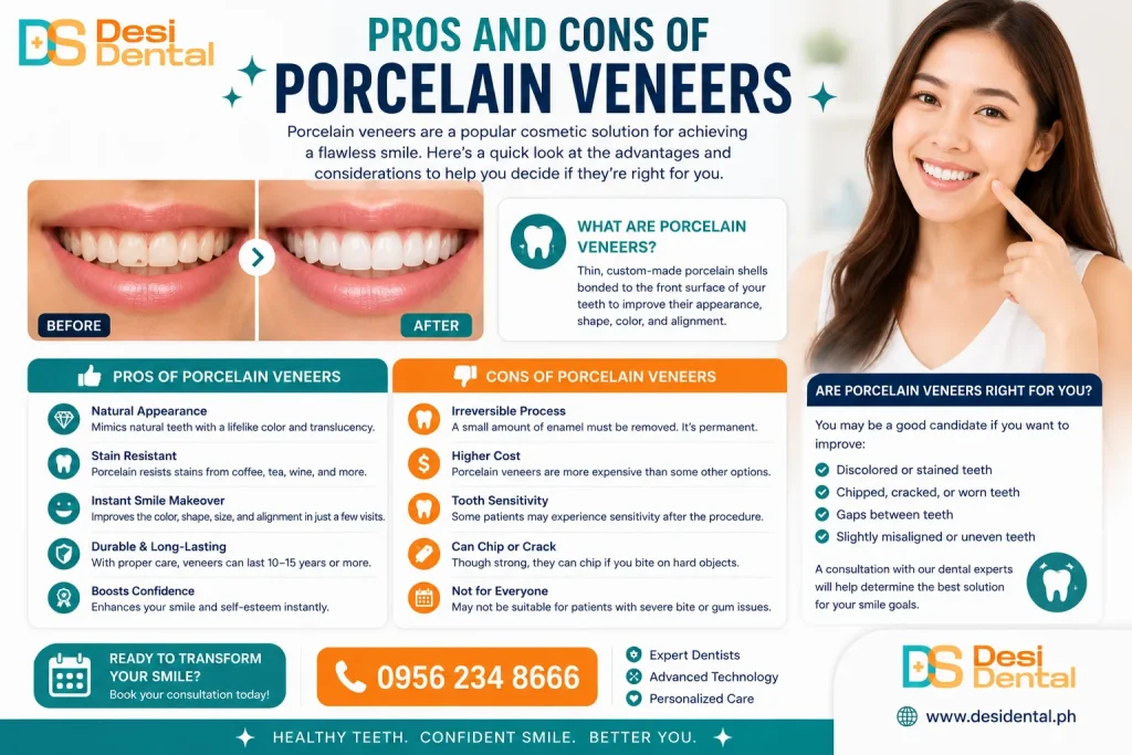 Pros and Cons of Porcelain Veneers
