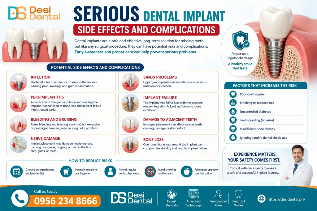 Serious Dental Implant Side Effects and Complications