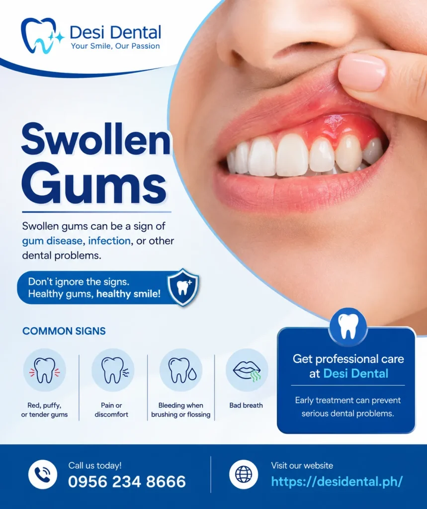 Swollen Gums