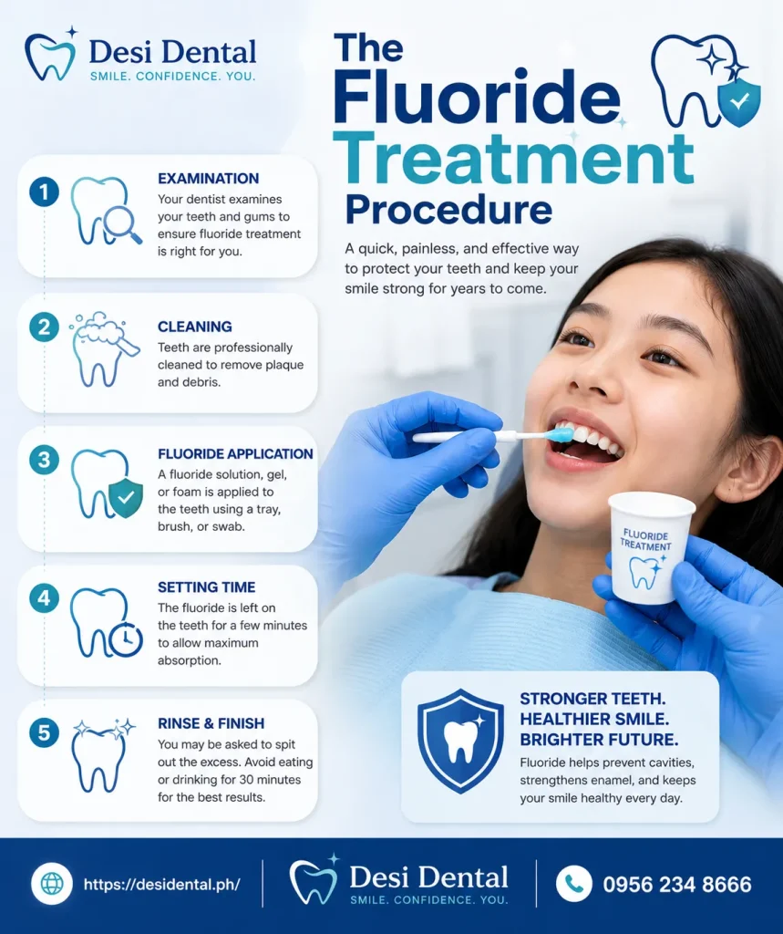 The Fluoride Treatment Procedure