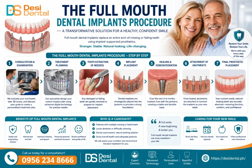The Full Mouth Dental Implants Procedure