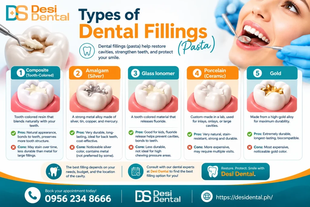 Types of Dental Fillings (Pasta)