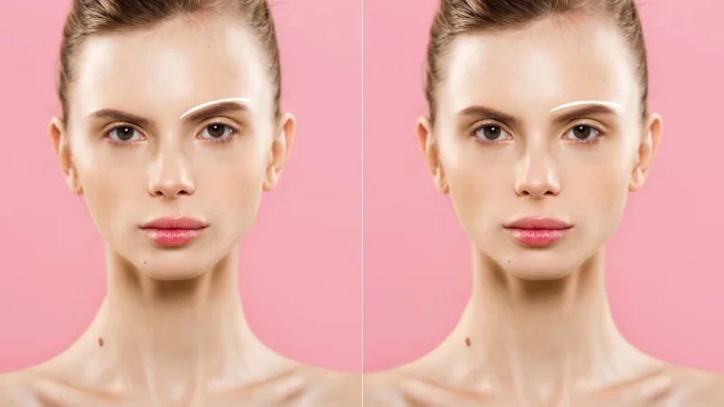 What Causes Asymmetrical Face and When Should You Fix It