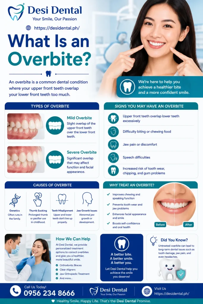 What Is an Overbite