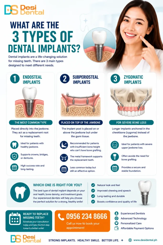 What are the 3 types of dental implants