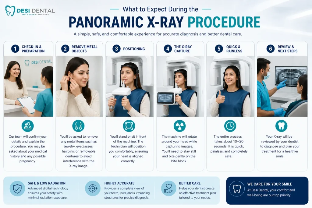 What to Expect During the Panoramic X-Ray Procedure