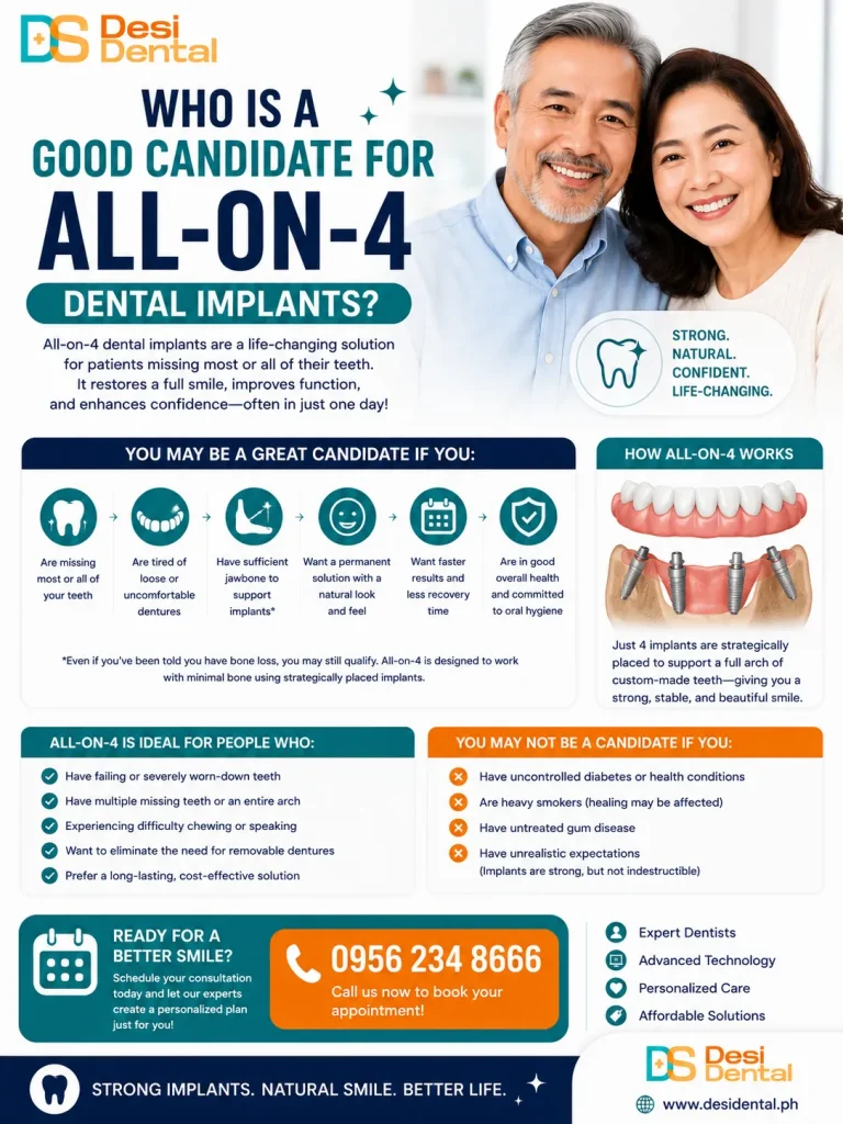 Who Is a Good Candidate for All-on-4 Dental Implants