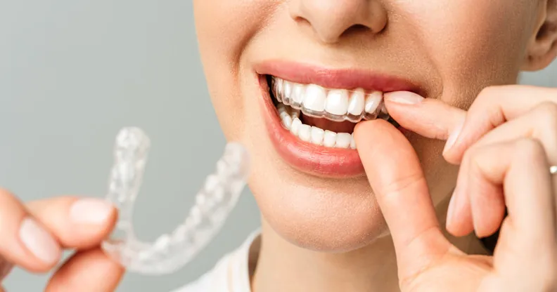 Why Do You Really Need Invisible Retainers