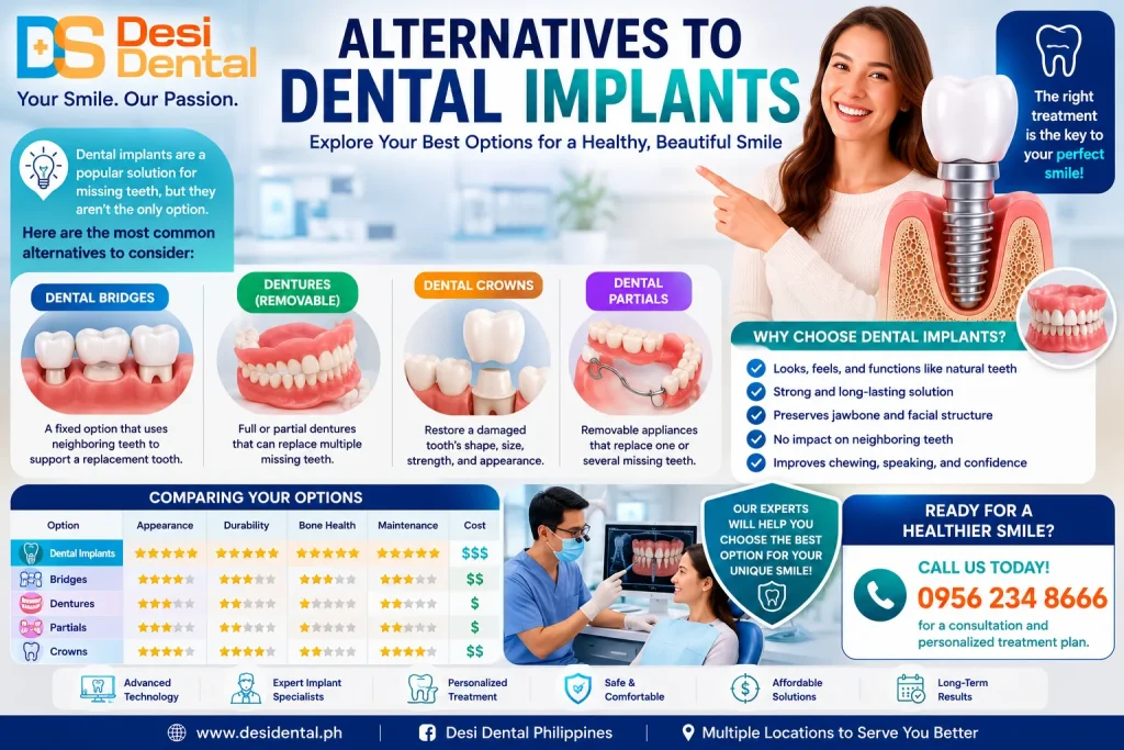 Alternatives to Dental Implants