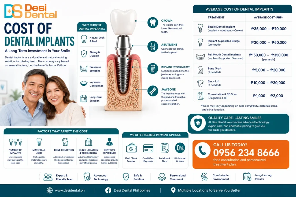 Cost of Dental Implants