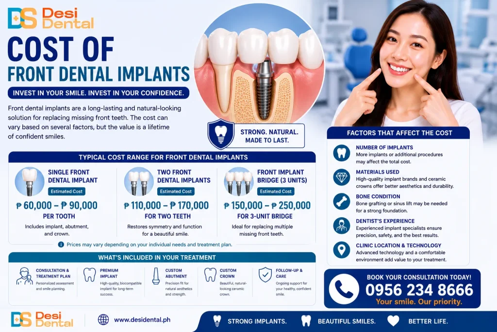 Cost of Front Dental Implants