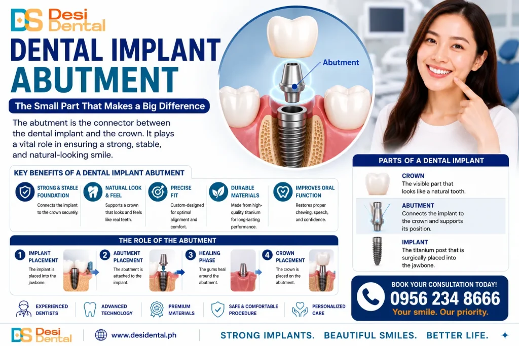 Dental Implant Abutment