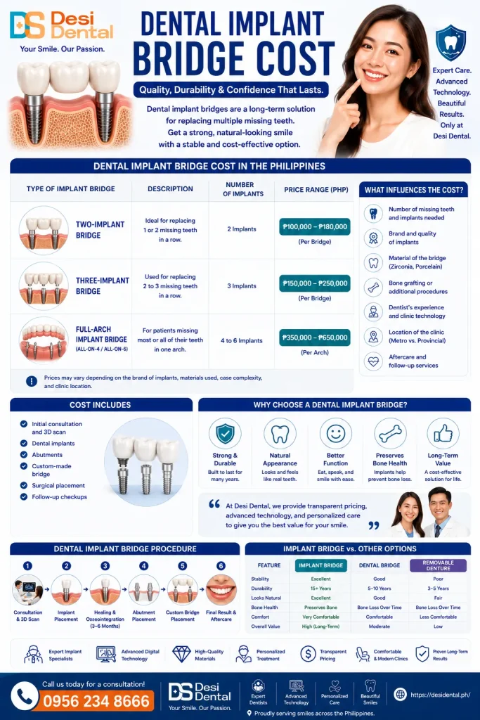 Dental Implant Bridge Cost