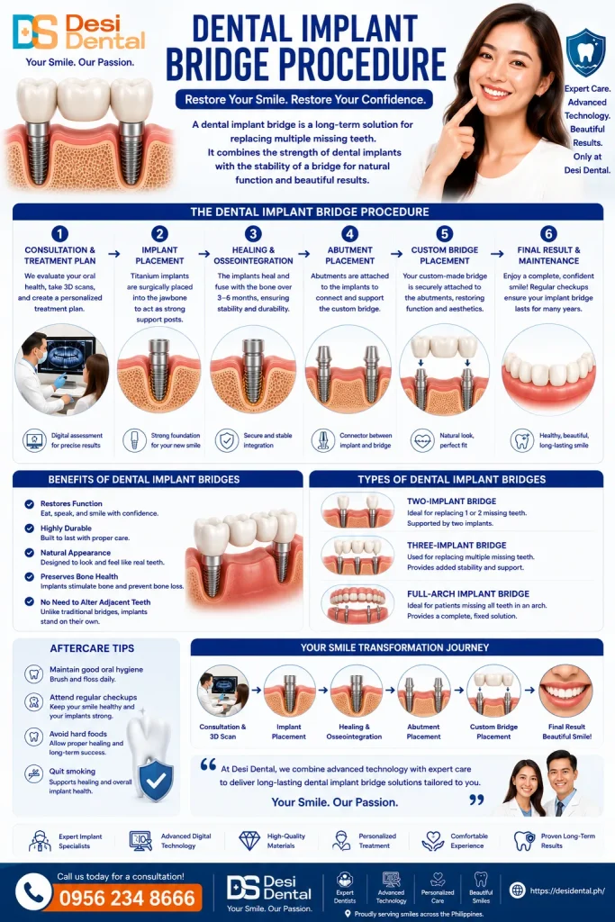 Dental Implant Bridge Procedure