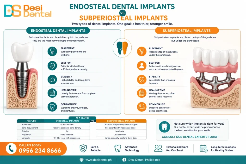 Endosteal Dental Implants vs. Subperiosteal Implants