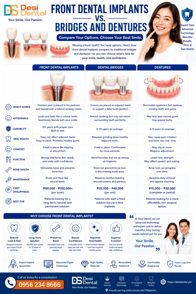 Front Dental Implants vs. Bridges and Dentures