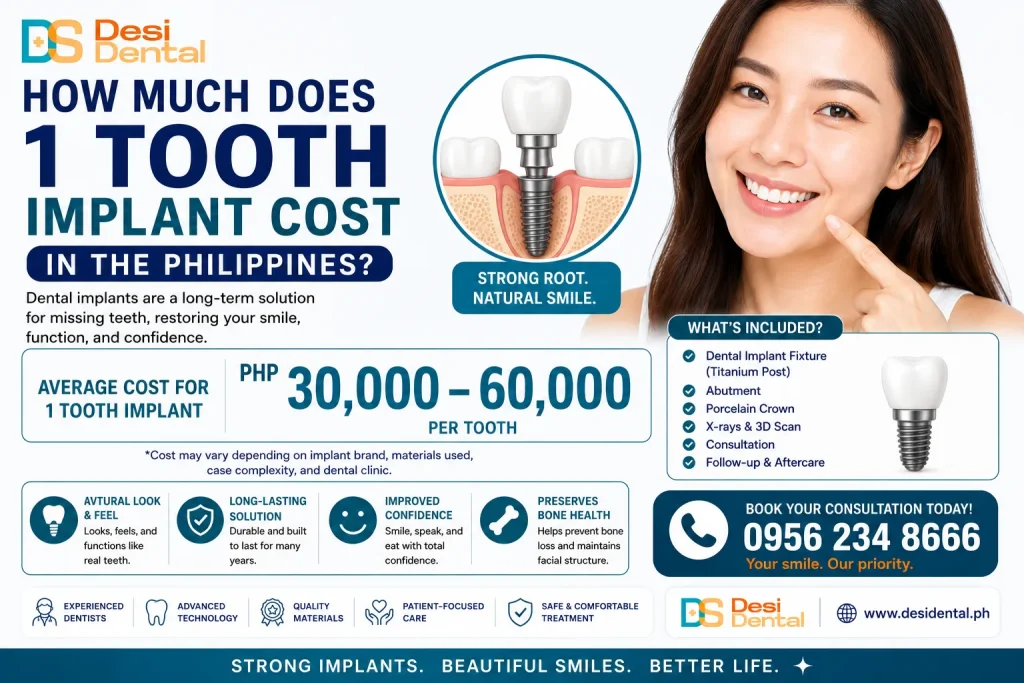 How much does 1 tooth implant cost in the Philippines