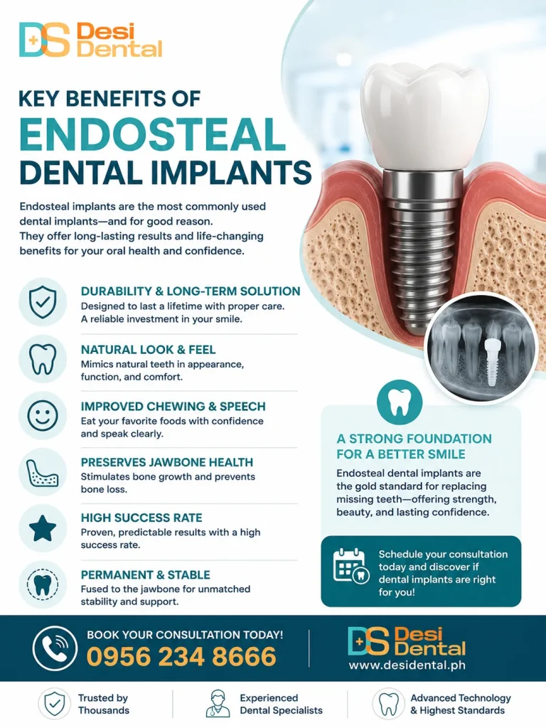 Key Benefits of Endosteal Dental Implants