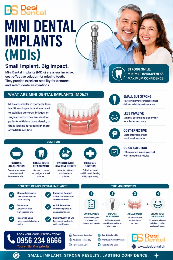 Mini Dental Implants (MDIs)
