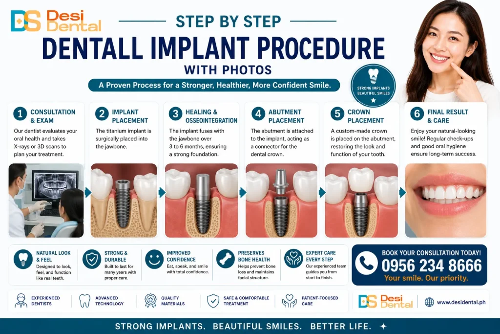 Step by Step Dental Implant Procedure with Photos