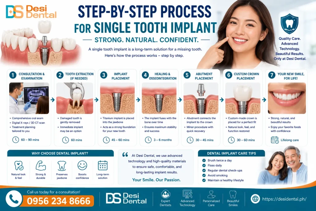 Step-by-Step Process for Single Tooth Implant