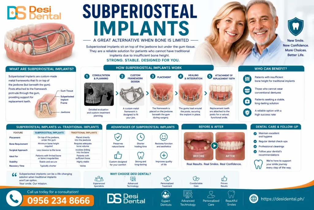 Subperiosteal Implants